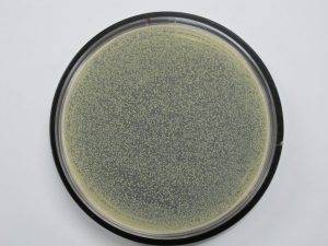 Sock without antimicrobial treatment