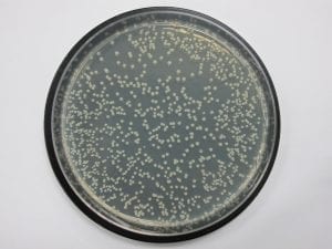 Bacteria recovered from untreated foam