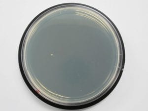 MRSA recovered from antibacterial plastic