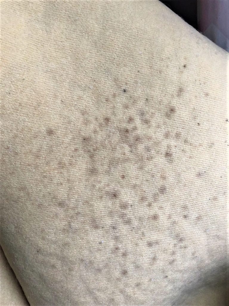 mold on mattress pad