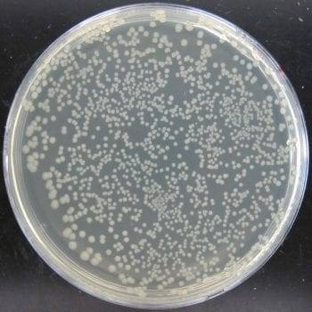E. coli from water storage tank